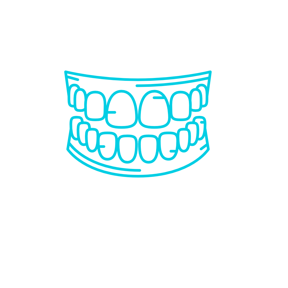 Facings
